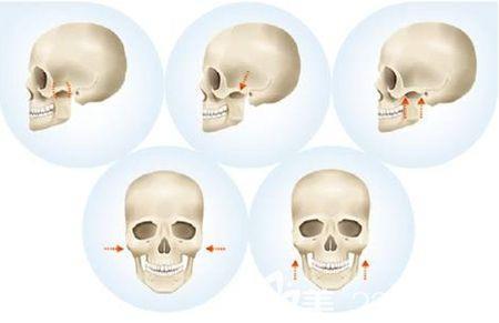 颧骨怎么样算宽(颧骨怎么样好看)